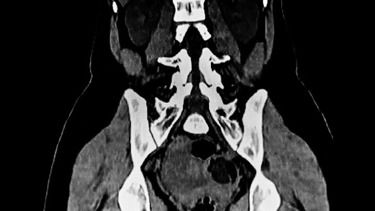 life-style-know-your-abdominal-pain