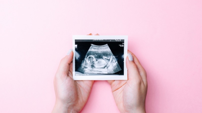 Ultrasound picture pregnant baby photo. Woman hands holding ultrasound pregnancy image on pink background. Concept of pregnancy, maternity, expectation for baby birth