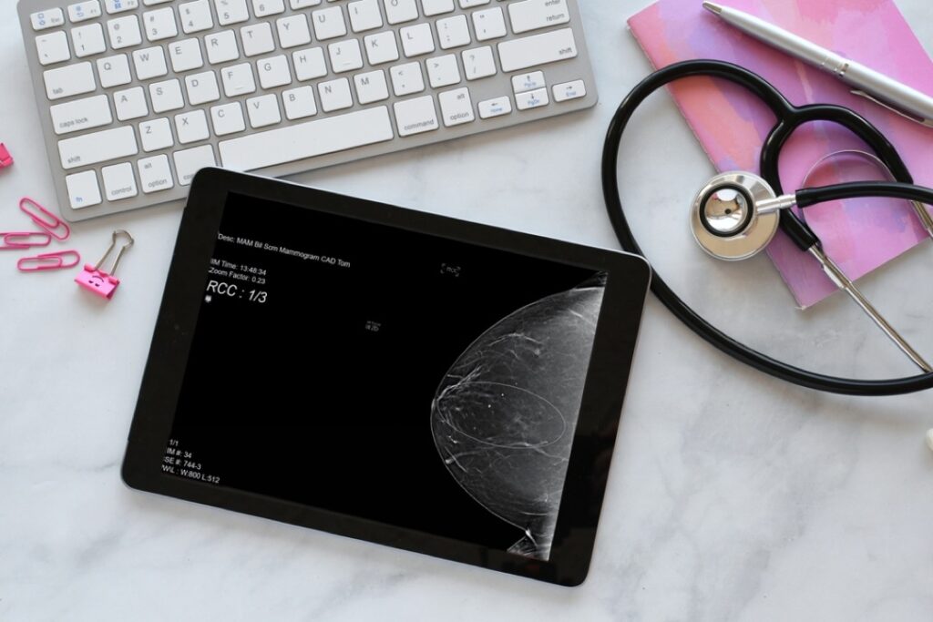 Diagnostic Mammogram scan on tablet screen of doctor or radiologist desk 