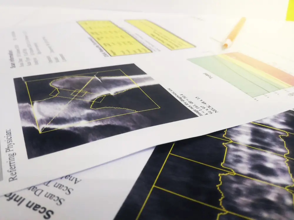 Bone Densitometry hip and lumbarspine Result.on bright background