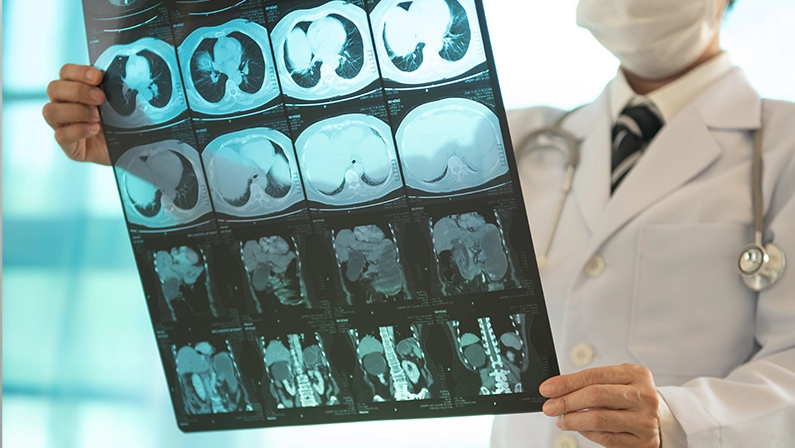 radiology concept. radiologist doctor examining at whole abdominal x-ray film of patient at hospital room.