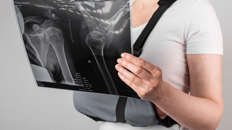 Woman wearing arm sling and looking at X-ray image. Female suffering from shoulder, clavicle, acromion fracture, strain. Health care, injury diagnostics concept. High quality photo