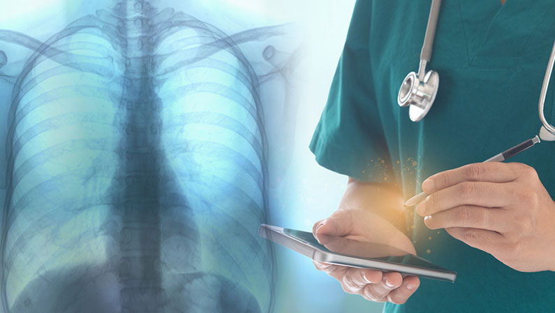 Doctor examining chest x-ray image to diagnose pneumonia lung, emphysema. lung radiography concept.
