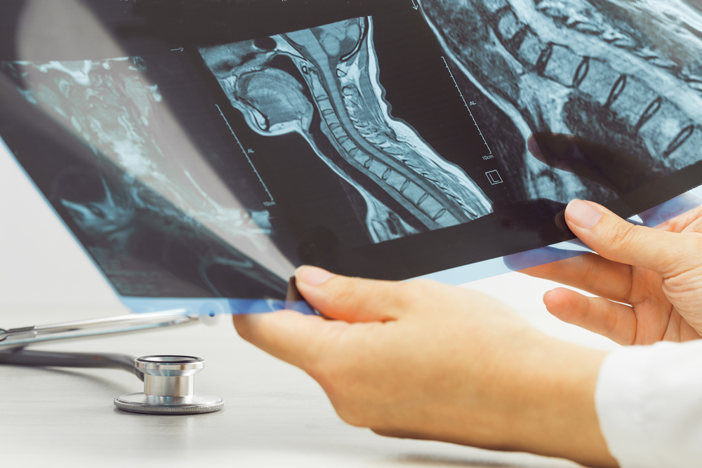 Female doctors hand pointing at x-ray or MRI medical imaging with a head and neck condition