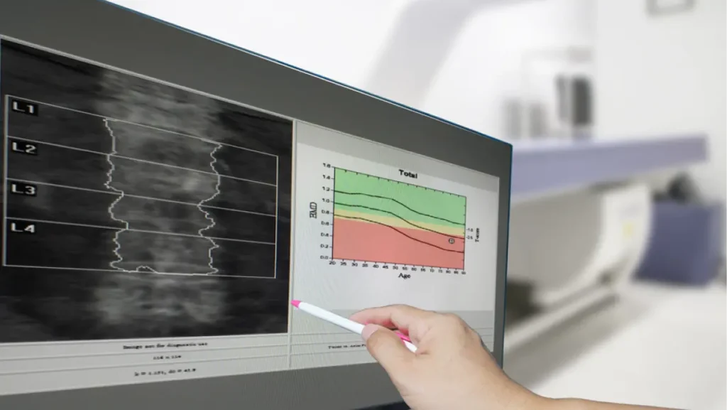 Close-up hand Doctor point Image of DXA bone density scan on a monitor in a woman of 50 years to prevent osteoporosis. blurry bone densitometer machine background.