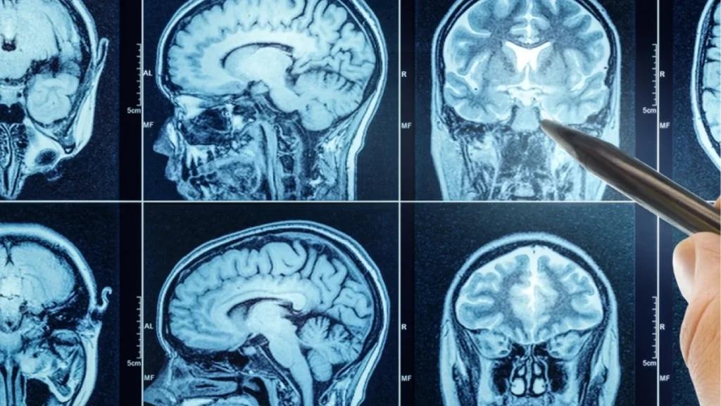 CT scan with brain and doctor's hand. Medical, science and mri brain background. Magnetic resonance imaging. The doctor is doing a brain test.
